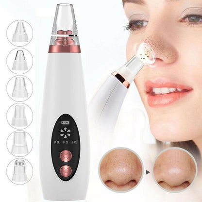 Blackhead Pore Vacuum Cleaner for Acne, Blackhead Removal, Nose Cleanser, Skin Care.